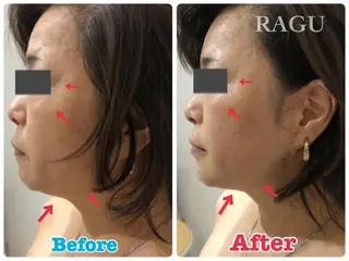 RAGU BEAUTY所属・原口 彩子のエステ・リラクイメージ