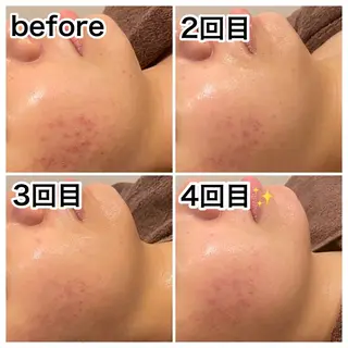 浜野 恵美のエステ・リラクイメージ