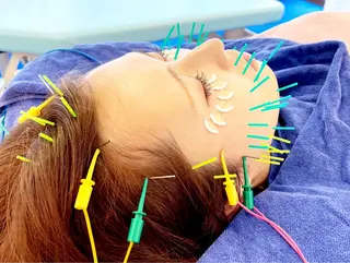 小顔美容鍼専門サロン 渋谷YZのエステ・リラクイメージ