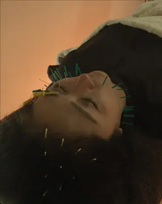 小顔矯正&美容鍼 東洋健美のエステ・リラクイメージ