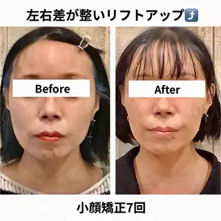 小顔矯正Speed KOGAO渋谷本店のエステ・リラクイメージ