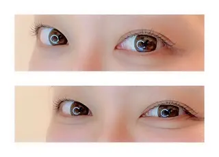 パーマ トータルサロンRuby所属・【医療提携】小顔 整体ハーブピーリングのその他イメージ