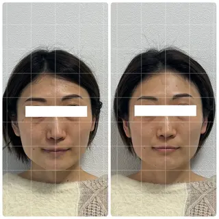 くつろぎ小顔サロン Lu mellow所属・片山けいこ｜ 美人顔創りの専門家のエステ・リラクイメージ