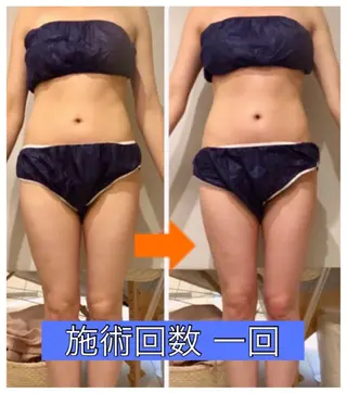 ショート カラー パーマ ヘアアレンジ メンズ キッズ ネイル マツエク・マツパ ‍痩身＆ボディ 結果出し🌟丹野のエステ・リラクイメージ