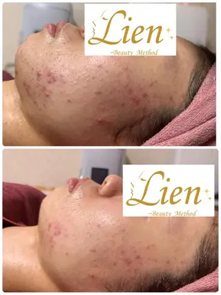 Lien オーナー　山口智嘉のエステ・リラクイメージ