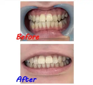 セルフホワイトニングサロン　ラヴィアン所属・ホワイトニングサロン La vie enのその他イメージ