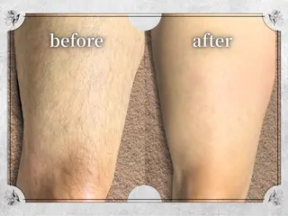 都度払い 脱毛 Lino柏/moeのエステ・リラクイメージ