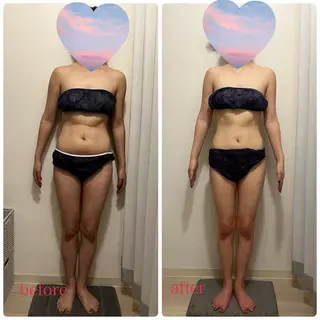 ボディ＆フェイシャルサロン SHINE-シャイン-所属・ボディ＆フェイシャル サロンSHINEのエステ・リラクイメージ