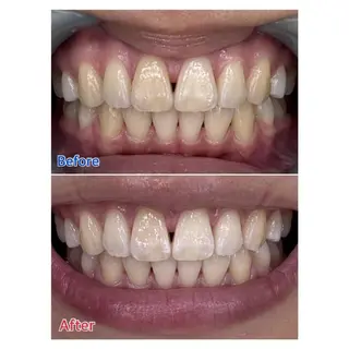 MBEAUTYSALON 千葉店・京成大久保所属・Melty 輝のその他イメージ