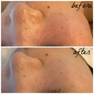 メンズ メナード岐阜市茜部 杉浦のエステ・リラクイメージ