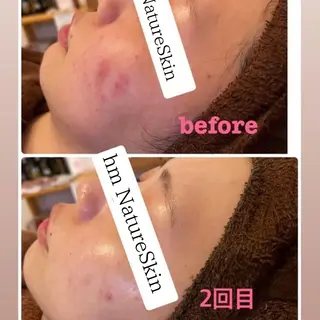 hm NATURESKINのエステ・リラクイメージ