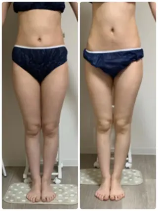 美ボディメイクサロン　only one body所属・所沢 痩身エステサロンのエステ・リラクイメージ