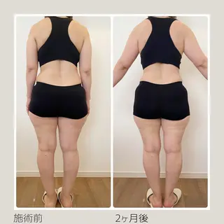 痩身＆ヘッド 長倉絵美のエステ・リラクイメージ