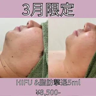 大阪市初！男性もok 酵素浴/痩身/小顔のその他イメージ