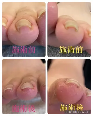 EYELASH SARONるみえーるのマツエク・マツパデザイン