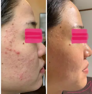 フェイシャルワックス 自然派エステファーノのその他イメージ