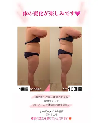 産後ダイエット−9㎏ Pourvous結衣のエステ・リラクイメージ