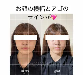 小顔と ヘッドスパのお店のエステ・リラクイメージ