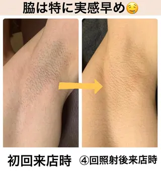 メンズ脱毛サロン Le falcoのエステ・リラクイメージ