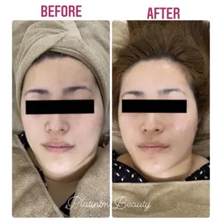 プラティーヌ ボーテ【もものり】のその他イメージ