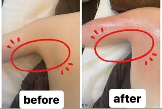 脱毛・エステサロン LuLuNのエステ・リラクイメージ