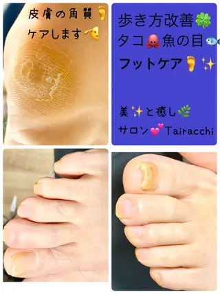 ネイル Tairacchi ﾀｲﾗｯﾁのエステ・リラクイメージ