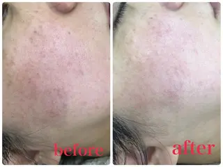 宮野 麻綺のエステ・リラクイメージ