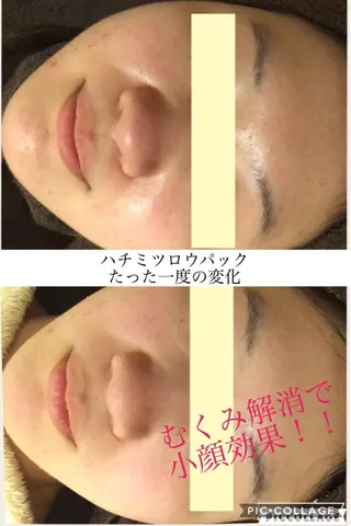 ニキビ・肌質改善専門 ♡人生が変わるサロンのエステ・リラクイメージ