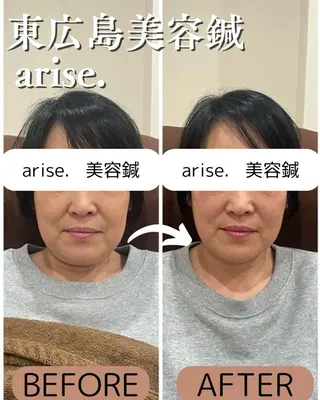 arise.所属・東広島美容鍼 /arise.のその他イメージ