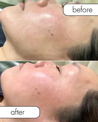 hug me. シュガーリングサロンのエステ・リラクイメージ