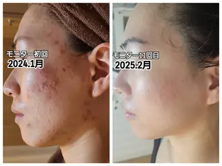 🌷U24特別サロン レイビス銀座店🌷のエステ・リラクイメージ