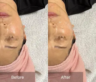 ALIA Scintiller  アリアサンティエ所属・齋藤 祐里耶のエステ・リラクイメージ