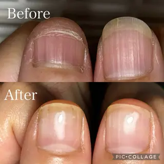 ネイル 深爪・自爪育成専門 MAHALOHIのネイルデザイン