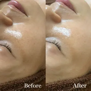 𝐌𝐚𝐜𝐡𝐞 𝐛𝐲 𝐌𝐚𝐲𝐮所属・ハーブピーリング🌿 𝑴𝒂𝒚𝒖のエステ・リラクイメージ