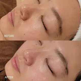 毛穴/肌管理/痩身/ ボディケア/satoのエステ・リラクイメージ