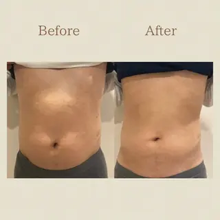 お腹痩せエステ Flat BELLY 恵比寿所属・【腸もみ/冷却痩身】 お腹エステ/恵比寿のエステ・リラクイメージ