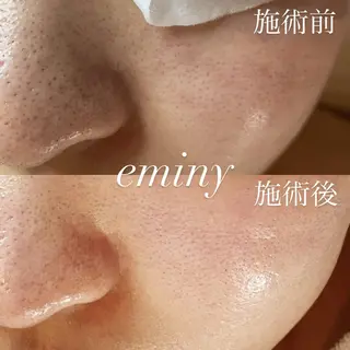 EMINY （エステティシャン）のエステ・リラクイメージ