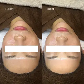 【韓国人肌製作所】 水光肌ならアーネストのエステ・リラクイメージ