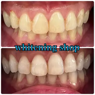 ホワイトニングショップ津店所属・ホワイトニング ショップ津店のその他イメージ