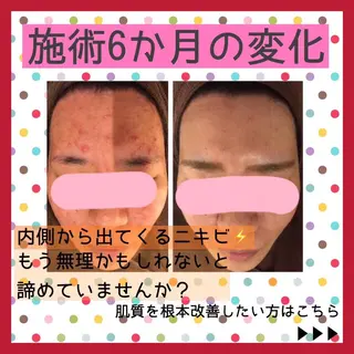 ミディアム カラー パーマ ヘアアレンジ メンズ キッズ ネイル マツエク・マツパ アイブロウ ニキビ・肌質改善専門 ♡人生が変わるサロンのエステ・リラクイメージ