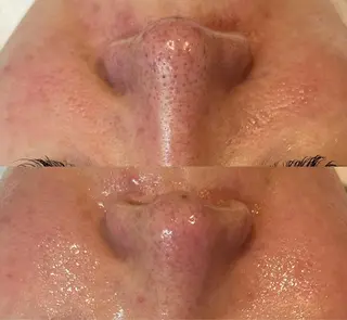 韓国系得意🦋 Aspire.のマツエク・マツパデザイン