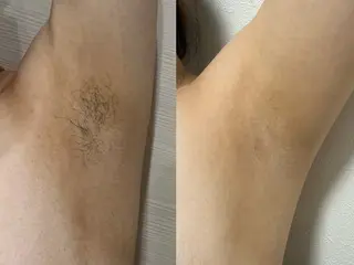 More   Beauty所属・More Beautyのエステ・リラクイメージ