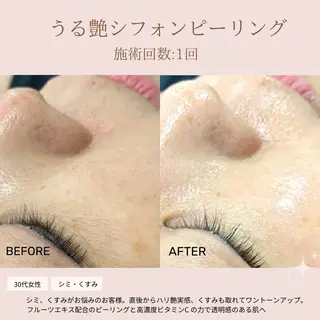 肌質改善専門サロン Bellmi/心斎橋のエステ・リラクイメージ