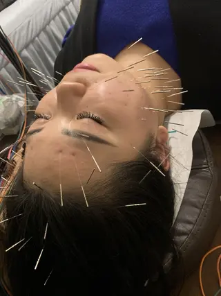 表参道鍼灸院K 美容鍼🔮ララピールのエステ・リラクイメージ