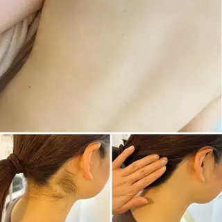 うなじ脱毛/美肌脱毛 LABELのエステ・リラクイメージ