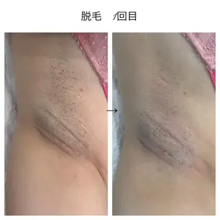 ビューティー ミロワールのエステ・リラクイメージ