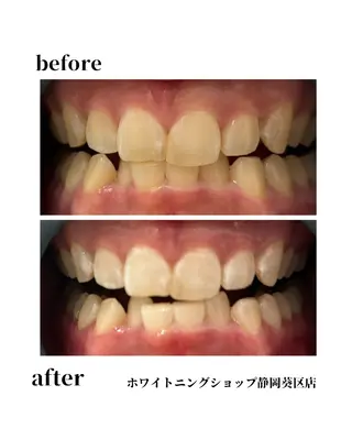 ホワイトニングショップ静岡葵区店所属・ホワイトニング ショップ葵区静岡駅店のその他イメージ