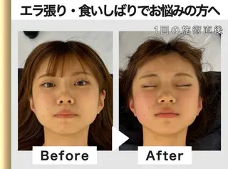 小顔矯正 骨盤矯正 美容整体サロン ELVISA TOKYO 恵比寿院所属・古川 智也のエステ・リラクイメージ