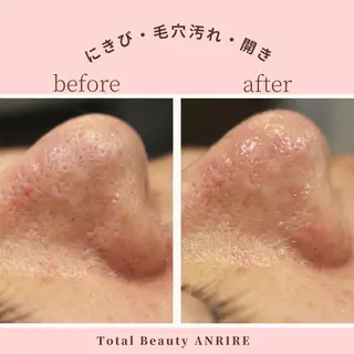 ANRIRE (アンリール)のエステ・リラクイメージ