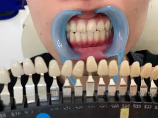 メンズ 217whitening  room所属・217 ホワイトニングルームのエステ・リラクイメージ